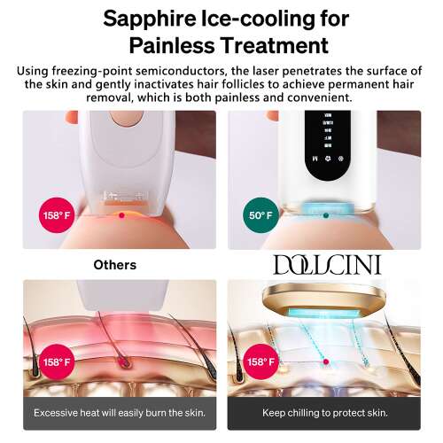 Dollcini IPL Lézeres Szőrtelenítő – Jéghideg Technológia, Teljes Testre